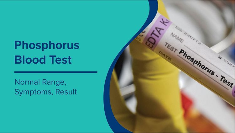 Phosphorus Blood Test: Normal Range & What Your Results Mean