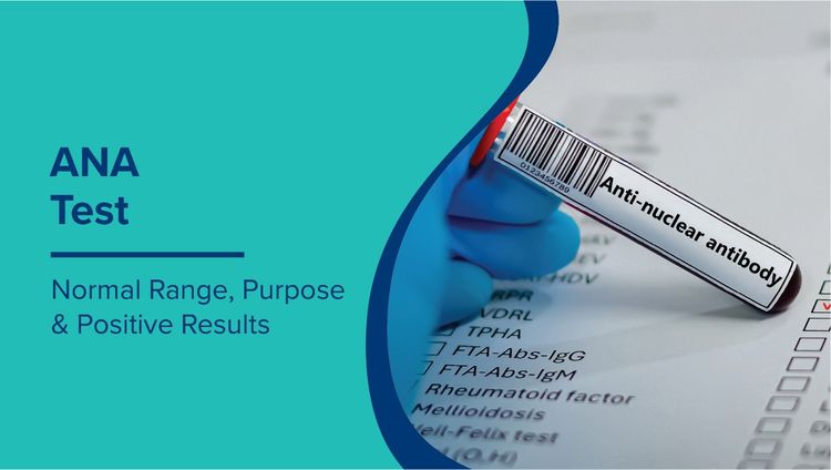 ANA Test Normal Range: What Positive, Negative, High, and Low Values Mean