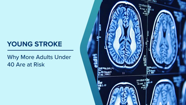 Signs of Stroke in Young Adults
