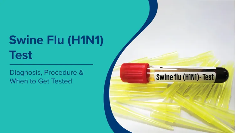 स्वाइन फ्लू (H1N1) परीक्षण (Swine Flu/H1N1 Test in Hindi): निदान, प्रक्रिया और कब परीक्षण करवाना चाहिए