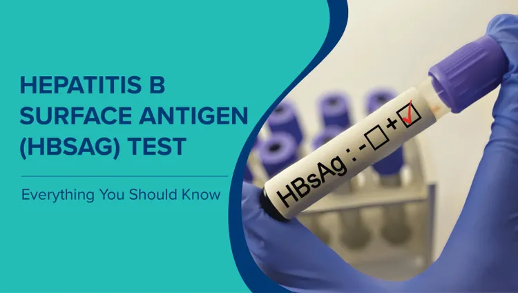 हेपेटाइटिस बी सरफेस एंटीजन परीक्षण (HBsAg Test in Hindi): वह सब जो आपको जानना आवश्यक है
