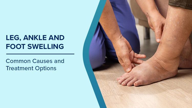 Leg Ankle Swelling