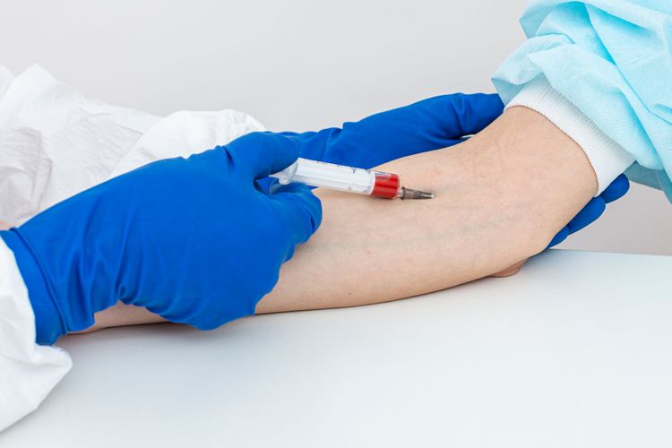 C3 Complement Blood Test