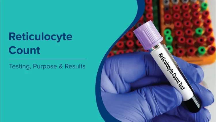 रेटिकुलोसाइट गणना (Reticulocyte Count in Hindi): परीक्षण, उद्देश्य और परिणाम