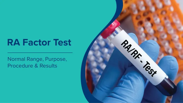 आरए फैक्टर टेस्ट (RA Factor Test in Hindi): सामान्य सीमा, उद्देश्य, प्रक्रिया और परिणाम 