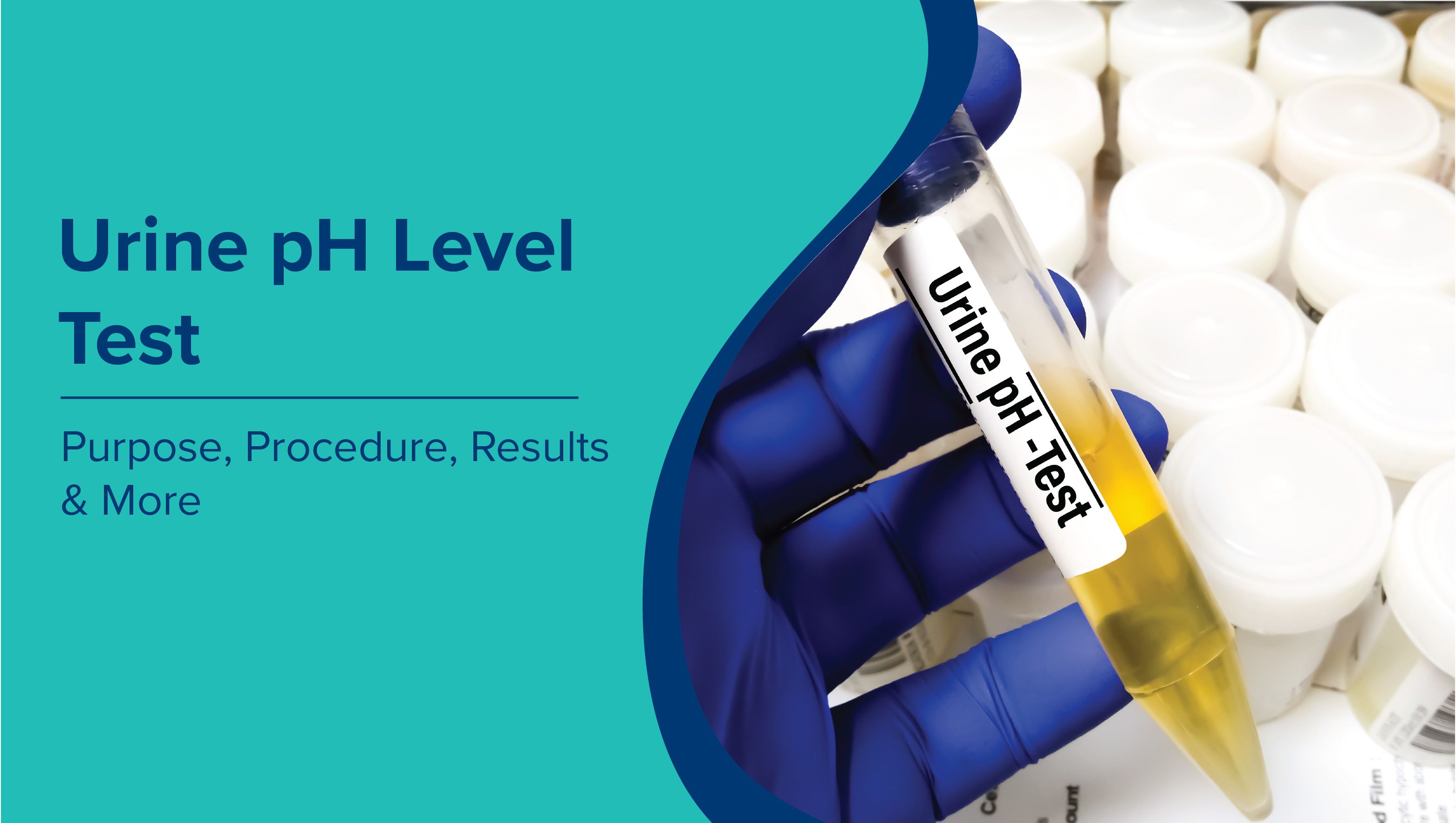 Urine pH Level Test: Purpose, Procedure, Results & More