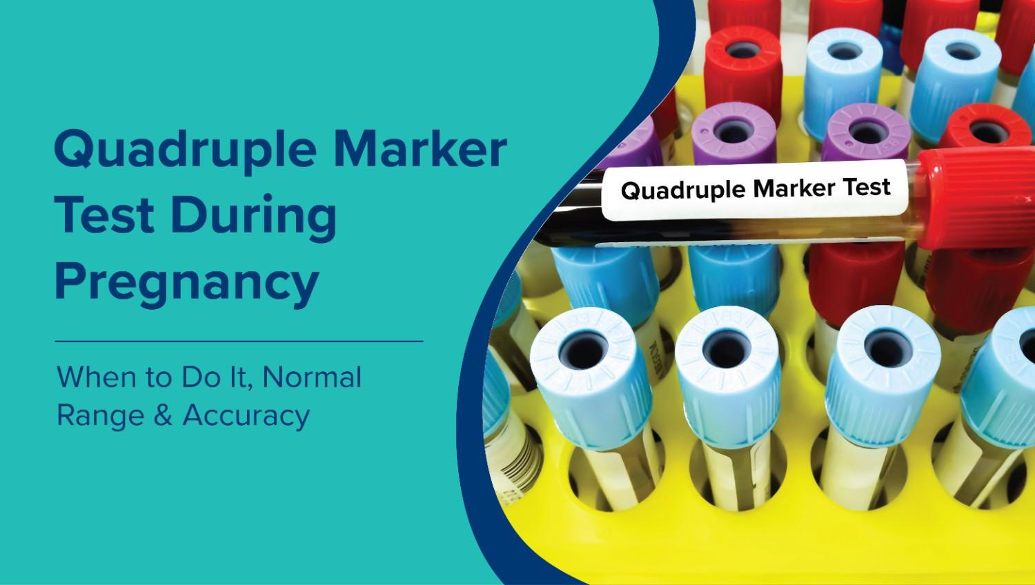 Quadruple Marker Test During Pregnancy: When to Do It, Normal Range & Accuracy