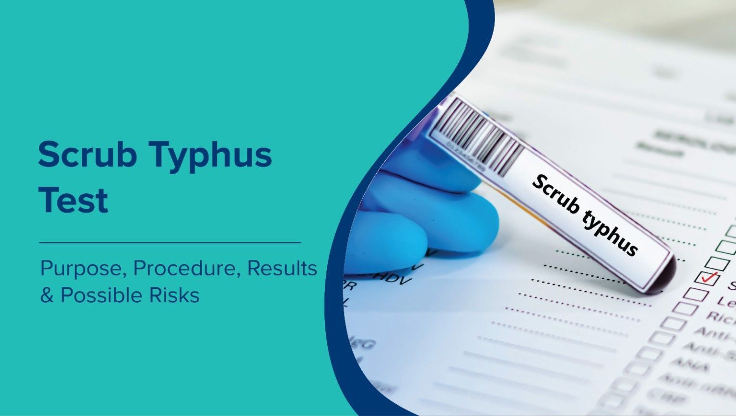 Scrub Typhus Test: Purpose, Procedure, Results, and Possible Risks